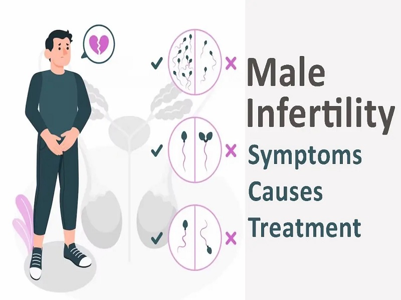 Male Infertility